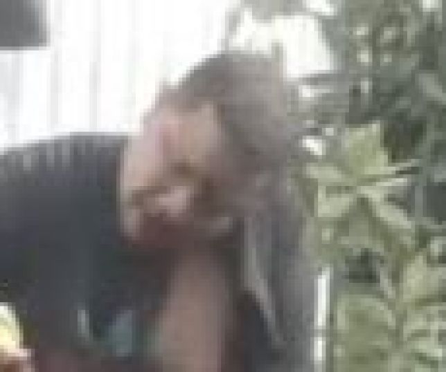 Homem perde a mão após explosão de sacola deixada em frente à sua casa. VEJA VÍDEO